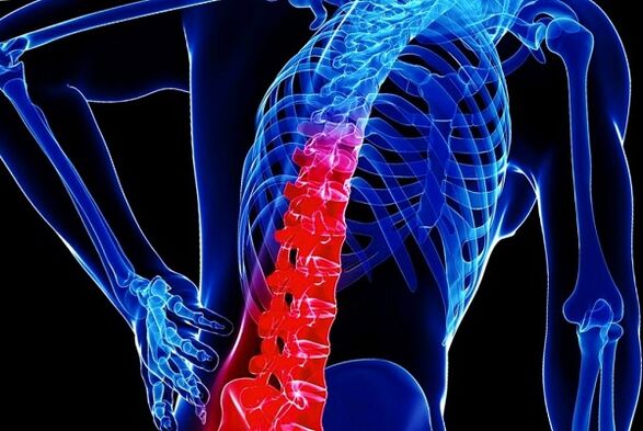 The reasons for the development of the Toracic osteochondosis