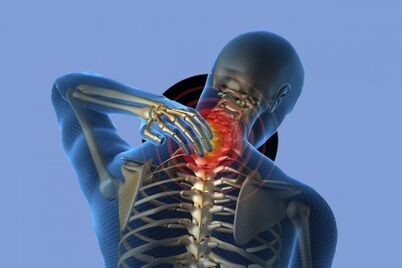 neck pain with osteochondosis