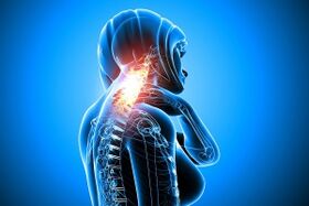 osteochondrosis in the cervical column